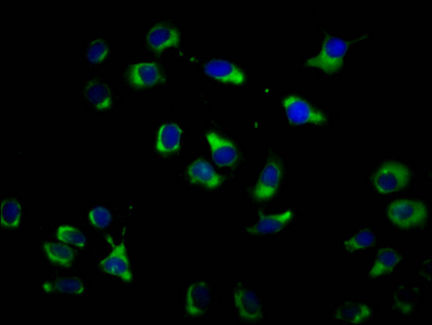 Encephalopsin / OPN3 Antibody - Immunofluorescence staining of A549 cells diluted at 1:100, counter-stained with DAPI. The cells were fixed in 4% formaldehyde, permeabilized using 0.2% Triton X-100 and blocked in 10% normal Goat Serum. The cells were then incubated with the antibody overnight at 4°C.The Secondary antibody was Alexa Fluor 488-congugated AffiniPure Goat Anti-Rabbit IgG (H+L).