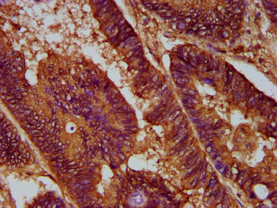 Encephalopsin / OPN3 Antibody - Immunohistochemistry Dilution at 1:300 and staining in paraffin-embedded human colon cancer performed on a Leica BondTM system. After dewaxing and hydration, antigen retrieval was mediated by high pressure in a citrate buffer (pH 6.0). Section was blocked with 10% normal Goat serum 30min at RT. Then primary antibody (1% BSA) was incubated at 4°C overnight. The primary is detected by a biotinylated Secondary antibody and visualized using an HRP conjugated SP system.