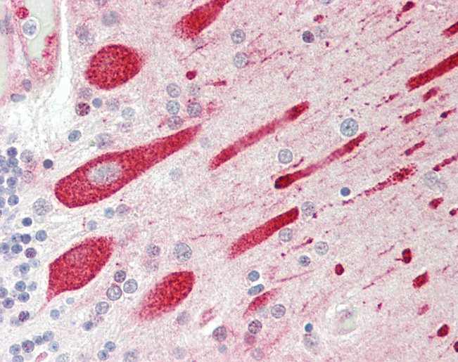 ENDOD1 Antibody - Human Brain, Cerebellum: Formalin-Fixed, Paraffin-Embedded (FFPE).  This image was taken for the unconjugated form of this product. Other forms have not been tested.