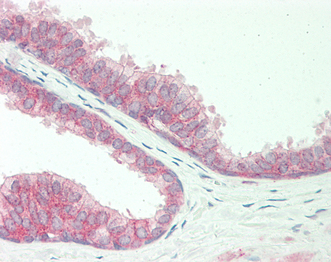 ENDOD1 Antibody - Human Prostate: Formalin-Fixed, Paraffin-Embedded (FFPE).  This image was taken for the unconjugated form of this product. Other forms have not been tested.
