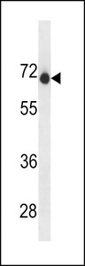 ENDOD1 Antibody - ENDOD1 Antibody western blot of A2058 cell line lysates (35 ug/lane). The ENDOD1 antibody detected the ENDOD1 protein (arrow).