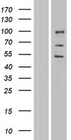 ENDOD1 Protein - Western validation with an anti-DDK antibody * L: Control HEK293 lysate R: Over-expression lysate