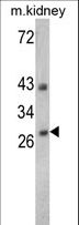 Endonuclease G / ENDOG Antibody - Western blot of ENDOG Antibody in 293,K562,Jurkat,NCI-H460 cell line lysates and mouse kidney tissues lysates(35 ug/lane). ENDOG (arrow) was detected using the purified antibody.