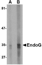 Endonuclease G / ENDOG Antibody - Western blot of EndoG expression in HepG2 cell lysate with EndoG antibody at (A) 5 and (B) 10 ug/ml.