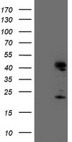 Endonuclease G / ENDOG Antibody - HEK293T cells were transfected with the pCMV6-ENTRY control (Left lane) or pCMV6-ENTRY ENDOG (Right lane) cDNA for 48 hrs and lysed. Equivalent amounts of cell lysates (5 ug per lane) were separated by SDS-PAGE and immunoblotted with anti-ENDOG.
