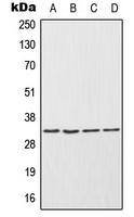 Endonuclease G / ENDOG Antibody - Western blot analysis of ENDOG expression in NCIH292 (A); HepG2 (B); Raw264.7 (C); PC12 (D) whole cell lysates.