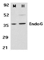 Endonuclease G / ENDOG Antibody - Western blot of EndoG in mouse (M) 3T3 and human (H) HepG2 cell lysates with EndoG antibody at 2 ug/ml.