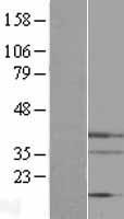 Endonuclease G / ENDOG Protein - Western validation with an anti-DDK antibody * L: Control HEK293 lysate R: Over-expression lysate