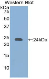 Endostatin Antibody - Western blot of recombinant COL18A1 / Endostatin.