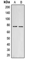 Endostatin Antibody - Western blot analysis of Collagen 18 alpha 1 expression in MCF7 (A); PC12 (B) whole cell lysates.