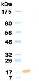 Endostatin Antibody - Western Blot of Endostatin antibody.
