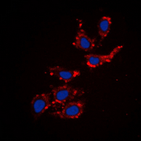 Endostatin Antibody - Immunofluorescent analysis of Collagen 18 alpha 1 staining in MCF7 cells. Formalin-fixed cells were permeabilized with 0.1% Triton X-100 in TBS for 5-10 minutes and blocked with 3% BSA-PBS for 30 minutes at room temperature. Cells were probed with the primary antibody in 3% BSA-PBS and incubated overnight at 4 ??C in a humidified chamber. Cells were washed with PBST and incubated with a DyLight 594-conjugated secondary antibody (red) in PBS at room temperature in the dark. DAPI was used to stain the cell nuclei (blue).