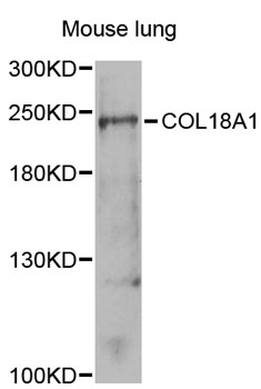 Endostatin Antibody - Western blot analysis of extracts of mouse lung, using COL18A1 antibody at 1:1000 dilution. The secondary antibody used was an HRP Goat Anti-Rabbit IgG (H+L) at 1:10000 dilution. Lysates were loaded 25ug per lane and 3% nonfat dry milk in TBST was used for blocking. An ECL Kit was used for detection and the exposure time was 90s.