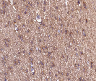 Endostatin Antibody - 1:100 staining human brain tissue by IHC-P. The tissue was formaldehyde fixed and a heat mediated antigen retrieval step in citrate buffer was performed. The tissue was then blocked and incubated with the antibody for 1.5 hours at 22°C. An HRP conjugated goat anti-rabbit antibody was used as the secondary.