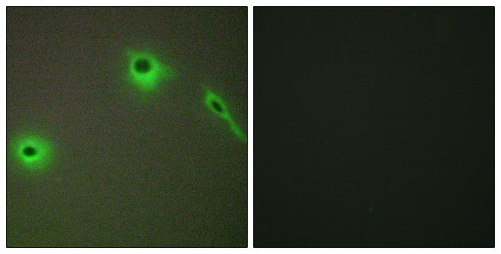 Endostatin Antibody - Peptide - + Immunofluorescence analysis of A549 cells, using Collagen XVIII a1 antibody.