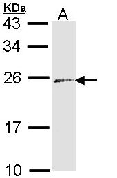 Endothelin 3 / EDN3 Antibody - Sample (30 ug of whole cell lysate). A: Raji. 12% SDS PAGE. Endothelin 3 / EDN3 antibody diluted at 1:1000.