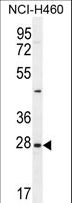 Endothelin 3 / EDN3 Antibody - EDN3 Antibody western blot of NCI-H460 cell line lysates (35 ug/lane). The EDN3 antibody detected the EDN3 protein (arrow).