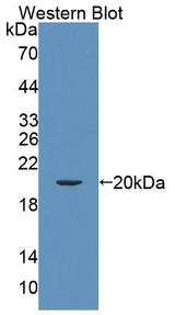Endothelin 3 / EDN3 Antibody - Western blot of Endothelin 3 / EDN3 antibody.