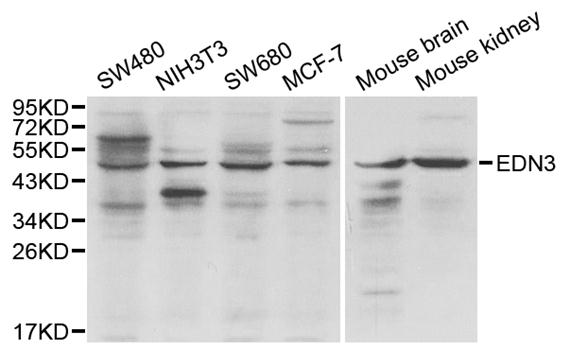 Endothelin 3 / EDN3 Antibody - Western blot analysis of extracts of various cell lines, using EDN3 antibody.
