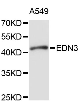 Endothelin 3 / EDN3 Antibody - Western blot analysis of extracts of A-549 cells, using EDN3 antibody at 1:1000 dilution. The secondary antibody used was an HRP Goat Anti-Rabbit IgG (H+L) at 1:10000 dilution. Lysates were loaded 25ug per lane and 3% nonfat dry milk in TBST was used for blocking. An ECL Kit was used for detection and the exposure time was 20s.