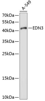 Endothelin 3 / EDN3 Antibody - Western blot analysis of extracts of A-549 cells using EDN3 Polyclonal Antibody at dilution of 1:1000.
