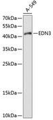 Endothelin 3 / EDN3 Antibody - Western blot analysis of extracts of A-549 cells using EDN3 Polyclonal Antibody at dilution of 1:1000.