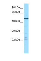 ENDOU Antibody - ENDOU / p11 antibody Western blot of Mouse Thymus lysate. Antibody concentration 1 ug/ml.  This image was taken for the unconjugated form of this product. Other forms have not been tested.