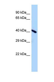 ENDOV Antibody - A730011L01Rik antibody Western blot of Mouse Brain lysate. Antibody concentration 1 ug/ml.  This image was taken for the unconjugated form of this product. Other forms have not been tested.