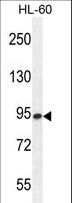 ENGASE Antibody - ENASE Antibody western blot of HL-60 cell line lysates (35 ug/lane). The ENASE antibody detected the ENASE protein (arrow).