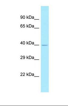 ENGASE Antibody - Western blot of 721_B. CSAG1 antibody dilution 1.0 ug/ml.  This image was taken for the unconjugated form of this product. Other forms have not been tested.
