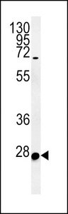 ENKUR Antibody - C10orf63 Antibody western blot of HL-60 cell line lysates (35 ug/lane). The C10orf63 antibody detected the C10orf63 protein (arrow).