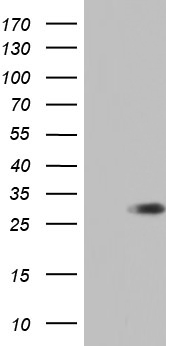 ENKUR Antibody - HEK293T cells were transfected with the pCMV6-ENTRY control (Left lane) or pCMV6-ENTRY ENKUR (Right lane) cDNA for 48 hrs and lysed. Equivalent amounts of cell lysates (5 ug per lane) were separated by SDS-PAGE and immunoblotted with anti-ENKUR.