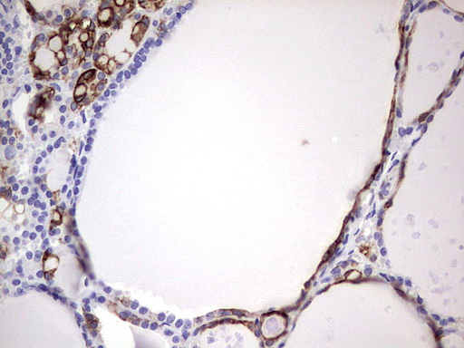 ENKUR Antibody - IHC of paraffin-embedded Human thyroid tissue using anti-ENKUR mouse monoclonal antibody. (Heat-induced epitope retrieval by 1 mM EDTA in 10mM Tris, pH8.5, 120°C for 3min).