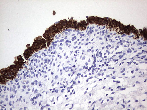 ENKUR Antibody - IHC of paraffin-embedded Human bladder tissue using anti-ENKUR mouse monoclonal antibody. (Heat-induced epitope retrieval by 1 mM EDTA in 10mM Tris, pH8.5, 120°C for 3min).