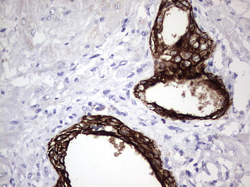 ENKUR Antibody - IHC of paraffin-embedded Human prostate tissue using anti-ENKUR mouse monoclonal antibody. (Heat-induced epitope retrieval by 1 mM EDTA in 10mM Tris, pH8.5, 120°C for 3min).