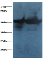 ENO1 / Alpha Enolase Antibody - Western blot of Alpha-enolase antibody at 2 ug/ml. Lane 1: EC109 whole cell lysate. Lane 2: 293T whole cell lysate. Secondary: Goat polyclonal to Rabbit IgG at 1:15000 dilution. Predicted band size: 47.7 kDa. Observed band size: 47.7 kDa.  This image was taken for the unconjugated form of this product. Other forms have not been tested.