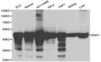 ENO1 / Alpha Enolase Antibody - Western blot of ENO1 pAb in extracts from PC3, Ramos, HC1-H460, Hela, THP1 cells and mouse kidney, liver tissues.