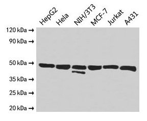 ENO1 / Alpha Enolase Antibody - Western Blot Positive WB detected in: HepG2 whole cell lysate, Mouse heart tissue, Mouse liver tissue, Mouse spleen tissue, Mouse lung tissue, Mouse kidney tissue, Mouse brain tissue, Mouse skeletal muscle tissue, Mouse thymus tissue All lanes: ENO1 antibody at 2.5 µg/ml Secondary Goat polyclonal to rabbit IgG at 1/10000 dilution Predicted band size: 48, 37 kDa Observed band size: 48 kDa