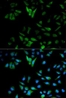ENO1 / Alpha Enolase Antibody - Immunofluorescence analysis of HeLa cells using ENO1 antibody. Blue: DAPI for nuclear staining.