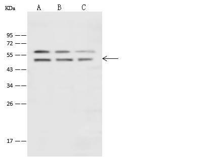ENO1 / Alpha Enolase Antibody - Anti-ENO1 rabbit polyclonal antibody at 1:500 dilution. Lane A: MCF7 Whole Cell Lysate. Lane B: Jurkat Whole Cell Lysate. Lane C: A431 Whole Cell Lysate. Lysates/proteins at 30 ug per lane. Secondary: Goat Anti-Rabbit IgG (H+L)/HRP at 1/10000 dilution. Developed using the ECL technique. Performed under reducing conditions. Predicted band size: 47 kDa. Observed band size: 47 kDa.
