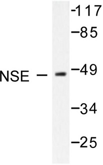 ENO2 / NSE Antibody - Western blot of NSE/ENO2 (R400) pAb in extracts from HepG2 cells.