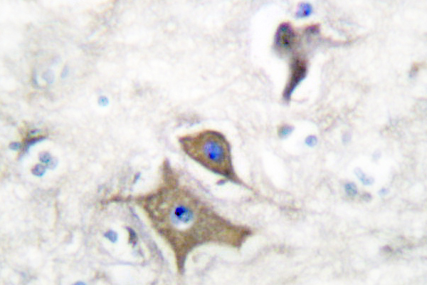ENO2 / NSE Antibody - IHC of NSE/ENO2 (R400) pAb in paraffin-embedded human brain tissue.