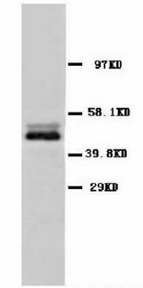 ENO2 / NSE Antibody -  This image was taken for the unconjugated form of this product. Other forms have not been tested.