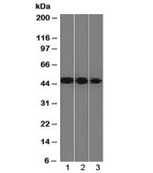 ENO2 / NSE Antibody - Western blot testing of human 1) Y79, 2) HeLa and 3) HepG2 cell lysate with NSE antibody (clone ENO2/1375). Predicted molecular weight ~47 kDa.