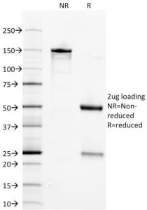 ENO2 / NSE Antibody - SDS-PAGE Analysis of Purified, BSA-Free NSE Antibody (clone ENO2/1375). Confirmation of Integrity and Purity of the Antibody.