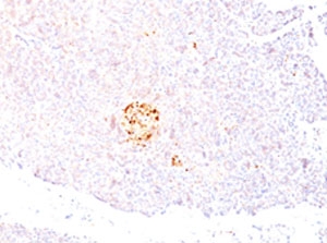ENO2 / NSE Antibody -  This image was taken for the unmodified form of this product. Other forms have not been tested.