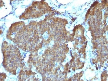 ENO2 / NSE Antibody - IHC testing of FFPE human pheochromocytoma with NSE antibody (clone SPM347). Required HIER: boil sections in 10mM citrate buffer, pH6, for 10-20 min.
