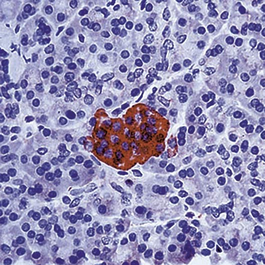 ENO2 / NSE Antibody - Formalin-fixed, paraffin-embedded human pancreas stained with NSE antibody.