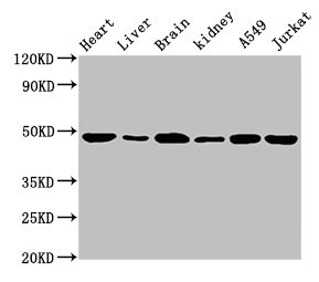 ENO2 / NSE Antibody - Western Blot Positive WB detected in: Mouse heart tissue, Mouse liver tissue, Mouse brain tissue, Mouse kidney tissue, A549 whole cell lysate, Jurkat whole cell lysate All lanes: ENO2 antibody at 1.5µg/ml Secondary Goat polyclonal to rabbit IgG at 1/10000 dilution Predicted band size: 48, 43 kDa Observed band size: 48 kDa