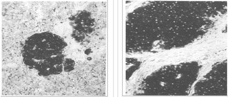 ENO2 / NSE Antibody - Left and Center: IHC of normal pancreas tissue (left) and small bowel tumor tissue (center) using NSE antibody. Right: Western blot of NSE antibodies on and enolase standards.